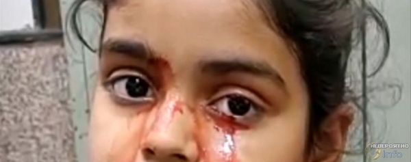 11-летняя девочка из Индии плачет кровью